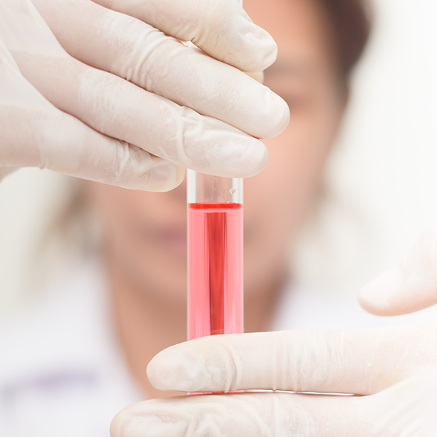 Biopsia de vellosidades coriales